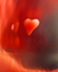 Tidlig 3D ultralyd — plommesekk som hjerte