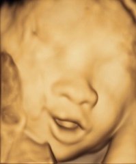 3D ultralyd — med et smil